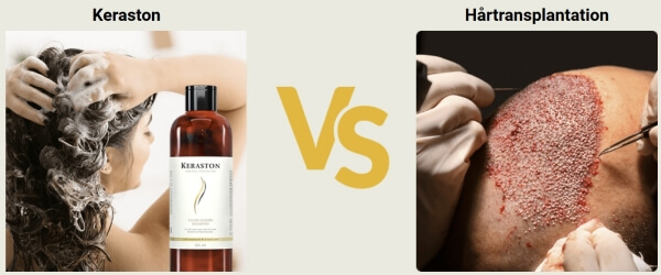 Keraston Käyttö - Annostus ja Käyttöohje Suomeksi